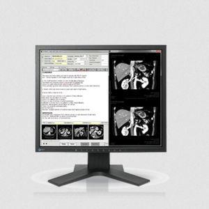 монитор LCD