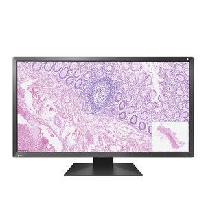 монитор LCD