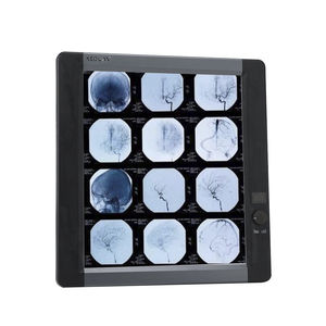 промышленный негатоскоп LED