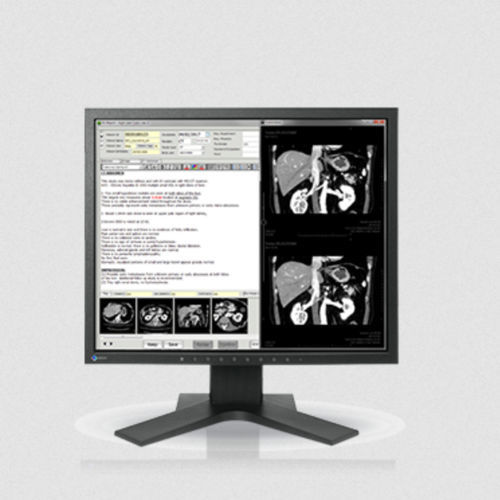 Монитор LCD - MX194 - EIZO NANAO - со светодиодной подсветкой / цифровой / для медицинской сферы