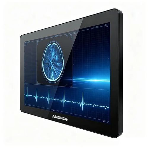 Монитор с сенсорным экраном - AMG-15OPTD01G1 - AMONGO Display Technology(ShenZhen)Co.,LTD - со светодиодной подсветкой / для медицинской сферы / 15,6"